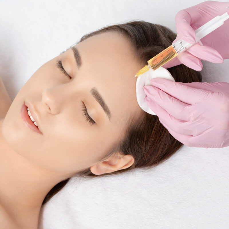 PRP Hair Restoration